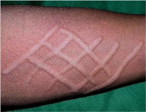 ݡ֢״Щ