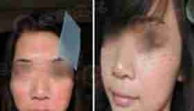 [Ƥ��]����÷ 19��-lni