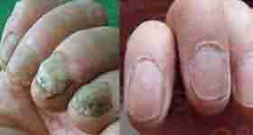 [��ָ��]֣�� 28��-lni