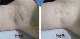 [Ҹ��]�ƻ� 22��-lni