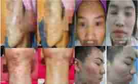 �����ҽ�����-lni