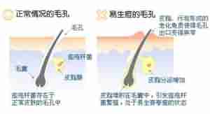 �����ҽ��-lni