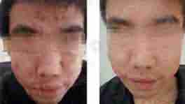 兰州北大皮肤病专科-lni