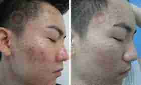 兰州北大皮肤病专科-lni