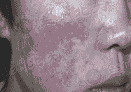 Ƥ Ͷ֢ƸƤ-lni