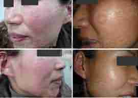 ������ҽ������Ʒ��ۺ��Ʒ���-lni