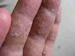 ��Σ������������ѢΣ�� ������Σ������-lni