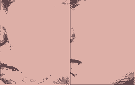 “微晶磨皮”祛痘印,快速彻底-lni