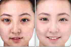 ���ݱ��󸴺ϲʹ��۷���-lni