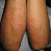 ���ݱ����������ҽ��-lni