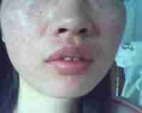 ����Ƥ������-lni