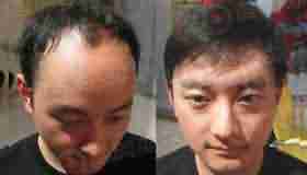 快速检测病因,止脱治脱,生发快-lni