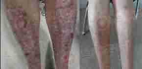Ҽ"ҽѪѢƷ"-lni