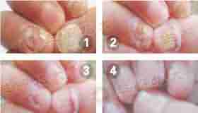 ���ݱ���Ƥ������������ƻ�ָ��Ч����-lni