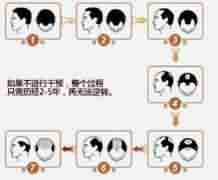 北大脱发治疗医生指出-lni