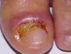 ���ݱ��󳫵���ѧ���Ƽ׹���-lni