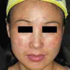 �������˽�ƺְ��γɲ��� �Ӹ�Դ���Ƽ���-lni