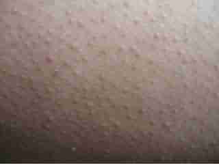 ����ë�ܽǻ� �������ݱ���-lni