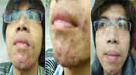 ӡҪǮ?-lni