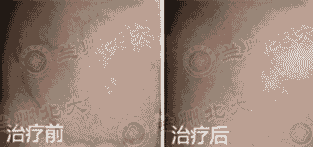 [ݡ����]Ҷ�� 22��-lni