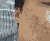 �����ഺ��Σ����-lni