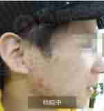 �����ҽ�����-lni