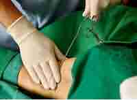 ����Ҹ��ҽ������Ҹ������-lni