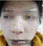 北大采用“中西医结合疗法”-lni