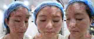 青春痘治不好,花一块钱都不值-lni