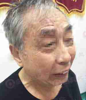 【症状】带状疱疹有哪些分类及症状-lni