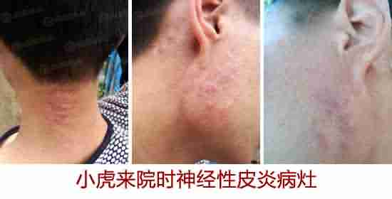 ����Ƥ�׺�����-lni