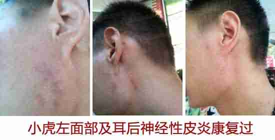 ����Ƥ�׺�����-lni