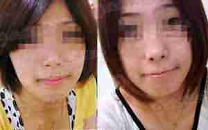 北大祛斑 真的不一“斑”-lni