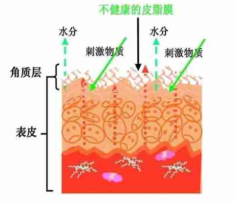查清过敏原,皮肤过敏就治好了80%-lni