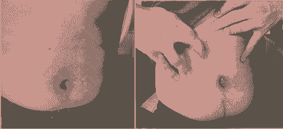 查清过敏原,皮肤过敏就治好了80%-lni