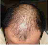 �ѷ����ƺò��ã���֢���ƺ���Ҫ-lni