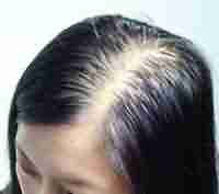 �ѷ����ƺò��ã���֢���ƺ���Ҫ-lni