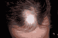 �ѷ����ƺò��ã���֢���ƺ���Ҫ-lni