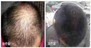 �ѷ����ƺò��ã���֢���ƺ���Ҫ-lni