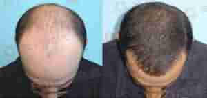 兰州北大皮肤病专科-lni