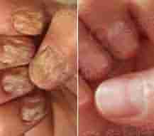 中西医绿色疗法-lni