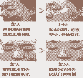 �����ഺ��Σ����-lni