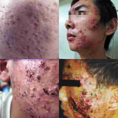 �����ع⡰Ƥ��ѻƬ��������񫡱ֻ�����ܣ�����ȴ��������-lni