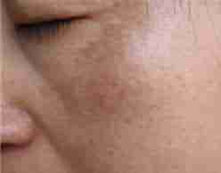 �˽�ƺְ�֢״ �緢��������-lni