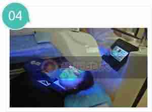 脸上长疙瘩如何治疗-lni