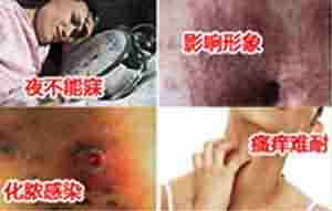 警惕!皮肤瘙痒的危害-lni