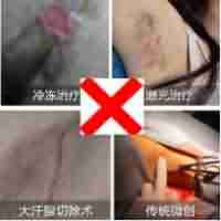 ҽ�����Ҹ��֢״ ��������������-lni