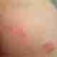 ƷƤЧǺ-lni