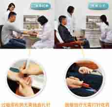 【费用】北大治疗皮肤过敏多少钱-lni