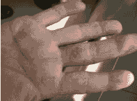 ����ҽ���������Ƥ����ô����-lni